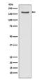 FA Complementation Group D2 antibody, M00563, Boster Biological Technology, Western Blot image 