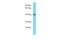 Rho Guanine Nucleotide Exchange Factor 39 antibody, A15438, Boster Biological Technology, Western Blot image 
