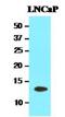 Tubulin Folding Cofactor A antibody, NBP1-30168, Novus Biologicals, Western Blot image 