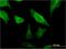 MOB Kinase Activator 1B antibody, H00092597-M07, Novus Biologicals, Immunocytochemistry image 