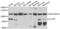 Chloride Voltage-Gated Channel 7 antibody, PA5-77054, Invitrogen Antibodies, Western Blot image 