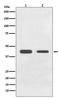 Growth Differentiation Factor 11 antibody, M02355, Boster Biological Technology, Western Blot image 