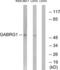 Gamma-Aminobutyric Acid Type A Receptor Gamma1 Subunit antibody, LS-C119990, Lifespan Biosciences, Western Blot image 