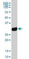 HLA class II histocompatibility antigen, DQ beta 1 chain antibody, H00003119-B01P, Novus Biologicals, Western Blot image 