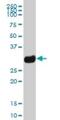Major Histocompatibility Complex, Class II, DQ Beta 1 antibody, H00003119-B01P, Novus Biologicals, Western Blot image 
