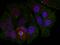 Myocyte Enhancer Factor 2A antibody, PA5-37643, Invitrogen Antibodies, Immunofluorescence image 