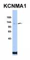 Potassium Calcium-Activated Channel Subfamily M Alpha 1 antibody, orb329808, Biorbyt, Western Blot image 