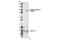 Catenin Delta 1 antibody, 2911S, Cell Signaling Technology, Western Blot image 