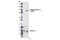 p120 catenin antibody, 2911S, Cell Signaling Technology, Western Blot image 