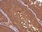 mDAPP1 antibody, GTX633252, GeneTex, Immunohistochemistry paraffin image 