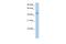 Phenylalanyl-TRNA Synthetase 2, Mitochondrial antibody, A08442, Boster Biological Technology, Western Blot image 