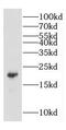 Copper Metabolism Domain Containing 1 antibody, FNab01850, FineTest, Western Blot image 