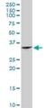 JAZF Zinc Finger 1 antibody, H00221895-D01P, Novus Biologicals, Western Blot image 