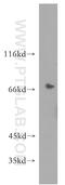 Sodium/hydrogen exchanger 9 antibody, 13718-1-AP, Proteintech Group, Western Blot image 