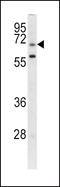 Leucine Rich Repeat Containing 32 antibody, LS-C98385, Lifespan Biosciences, Western Blot image 