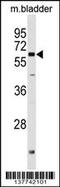 Phosphoglucomutase 2 Like 1 antibody, 59-741, ProSci, Western Blot image 