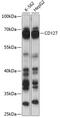 Interleukin 7 Receptor antibody, 15-029, ProSci, Western Blot image 