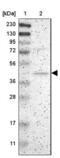 ArfGAP With Dual PH Domains 1 antibody, NBP1-88097, Novus Biologicals, Western Blot image 