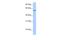 Acyl-CoA Synthetase Bubblegum Family Member 2 antibody, A12565, Boster Biological Technology, Western Blot image 