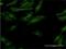 Interferon Gamma Receptor 2 antibody, H00003460-M01, Novus Biologicals, Immunofluorescence image 