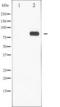 Signal Transducer And Activator Of Transcription 5A antibody, TA325903, Origene, Western Blot image 