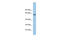 Glycine Receptor Alpha 3 antibody, ARP35063_P050, Aviva Systems Biology, Western Blot image 