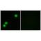CAMP-Dependent Protein Kinase Inhibitor Beta antibody, A12582, Boster Biological Technology, Immunohistochemistry paraffin image 
