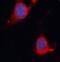 Inositol Polyphosphate-5-Phosphatase D antibody, FNab04328, FineTest, Immunofluorescence image 