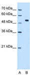 CFAP45 antibody, TA339192, Origene, Western Blot image 