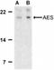 TLE Family Member 5, Transcriptional Modulator antibody, NBP1-76646, Novus Biologicals, Western Blot image 