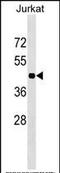 Homeobox C10 antibody, PA5-35189, Invitrogen Antibodies, Western Blot image 