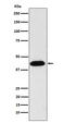 Nuclear Distribution C, Dynein Complex Regulator antibody, M00995, Boster Biological Technology, Western Blot image 