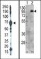 Phosphatidylinositol-4-Phosphate 5-Kinase Type 1 Gamma antibody, AP14965PU-N, Origene, Western Blot image 