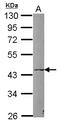 Purinergic Receptor P2X 5 antibody, LS-C155384, Lifespan Biosciences, Western Blot image 