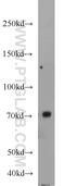 Ubiquilin 3 antibody, 23372-1-AP, Proteintech Group, Western Blot image 