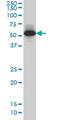 Myocyte Enhancer Factor 2A antibody, LS-B5468, Lifespan Biosciences, Western Blot image 