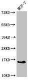 Cellular Retinoic Acid Binding Protein 2 antibody, CSB-PA005936LA01HU, Cusabio, Western Blot image 