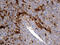 Zinc-alpha-2-glycoprotein antibody, M02718, Boster Biological Technology, Immunohistochemistry paraffin image 