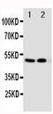 Vitamin D Receptor antibody, PA1983, Boster Biological Technology, Western Blot image 