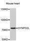 Synaptopodin 2 Like antibody, LS-C332614, Lifespan Biosciences, Western Blot image 