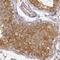 N-Myristoyltransferase 2 antibody, HPA001303, Atlas Antibodies, Immunohistochemistry paraffin image 