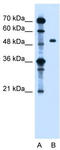 Zinc Finger FYVE-Type Containing 27 antibody, TA335290, Origene, Western Blot image 