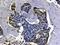Plasminogen Activator, Urokinase antibody, AF1310, R&D Systems, Immunohistochemistry paraffin image 