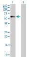 Probable serine carboxypeptidase CPVL antibody, H00054504-D01P, Novus Biologicals, Western Blot image 