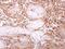 Inosine triphosphatase antibody, NBP1-32494, Novus Biologicals, Immunohistochemistry paraffin image 
