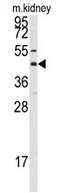 Gap Junction Protein Alpha 8 antibody, AP11582PU-N, Origene, Western Blot image 