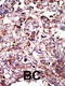 Farnesyltransferase, CAAX Box, Alpha antibody, 61-394, ProSci, Immunohistochemistry paraffin image 