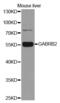 Gamma-Aminobutyric Acid Type A Receptor Beta2 Subunit antibody, MBS127353, MyBioSource, Western Blot image 