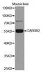 Gamma-aminobutyric acid receptor subunit beta-2 antibody, MBS127353, MyBioSource, Western Blot image 