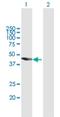 TBC1 Domain Family Member 16 antibody, H00125058-B01P, Novus Biologicals, Western Blot image 